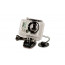 GoPro Camera Tethers 